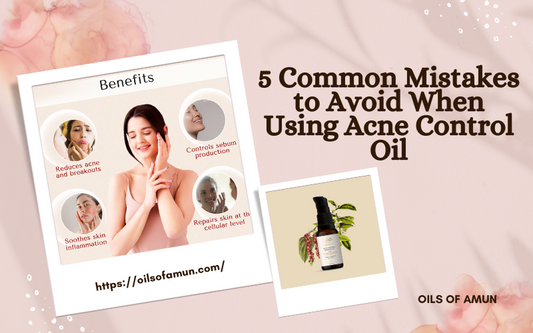 5 Common Mistakes to Avoid When Using Acne Control Oil