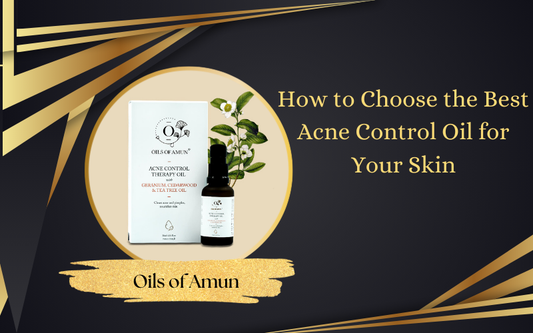 How to Choose the Best Acne Control Oil for Your Skin?